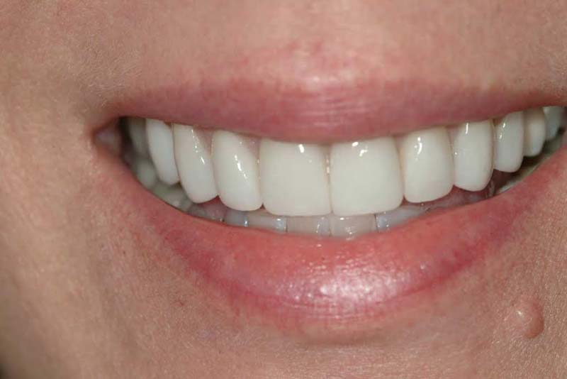 Smile gallery