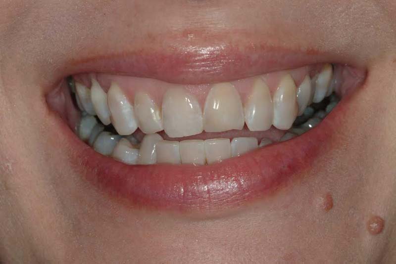 Smile gallery