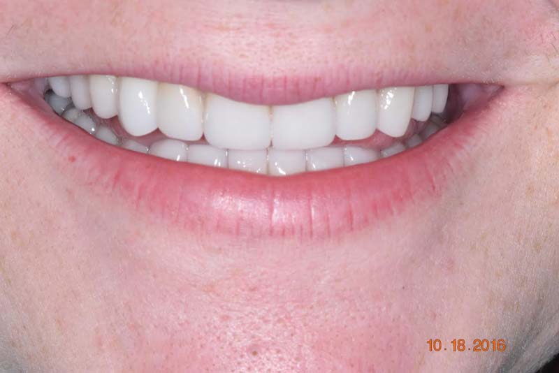 Smile gallery