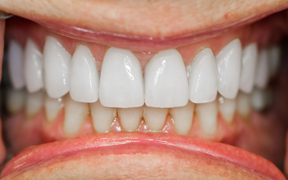 Smile gallery Smile gallery