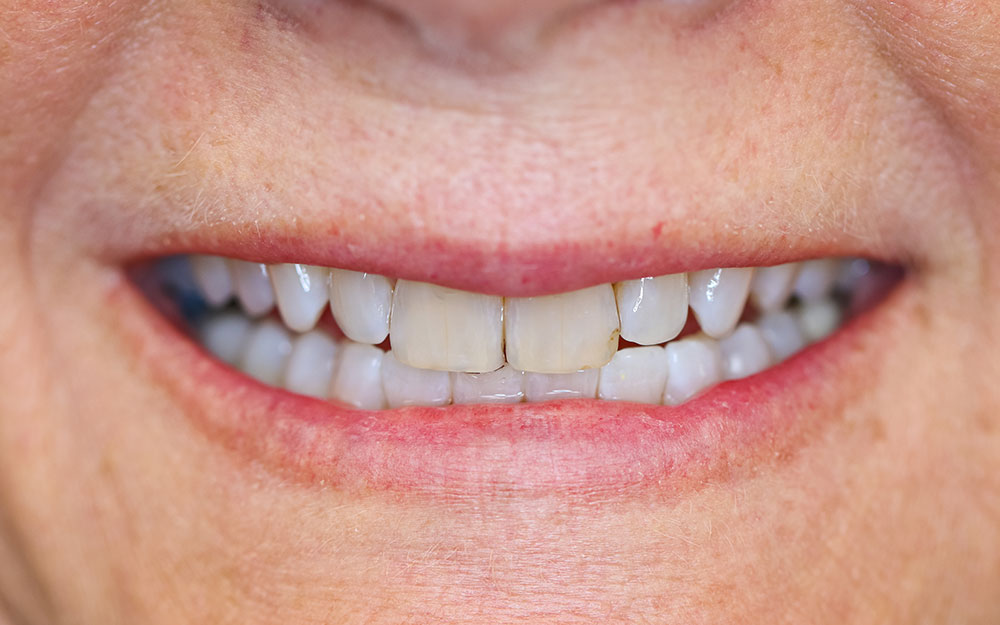 Smile gallery Smile gallery