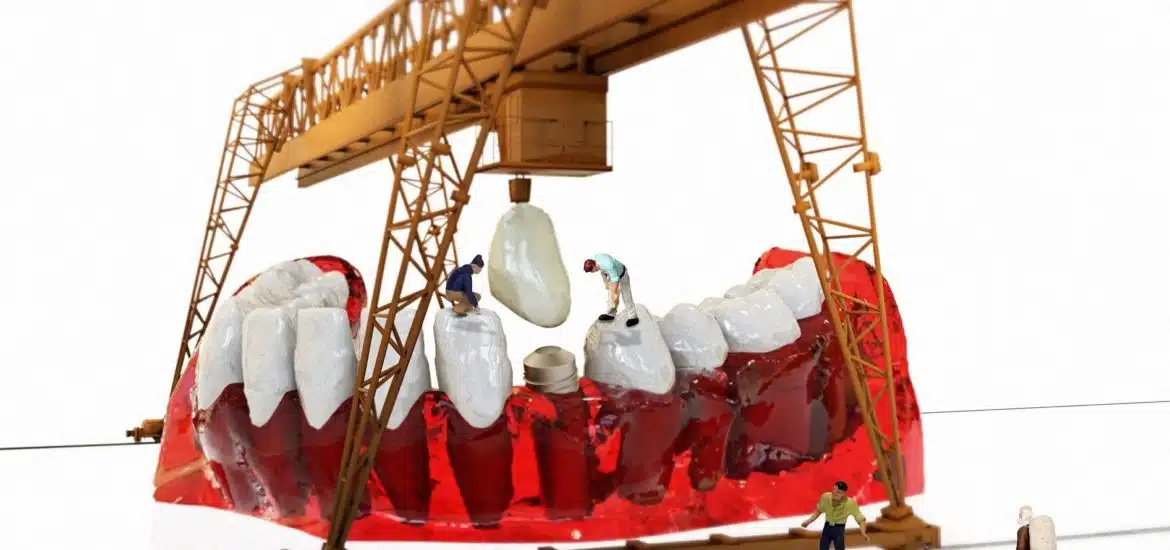 Kalispell_dental_implants_dentist