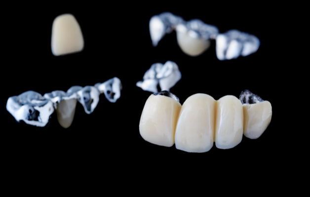 dental_implants_dentist_Kalispell