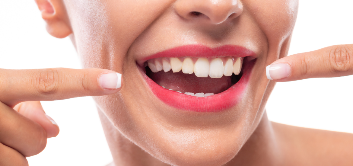 professional_teeth_whitening_Kalispell_dentist