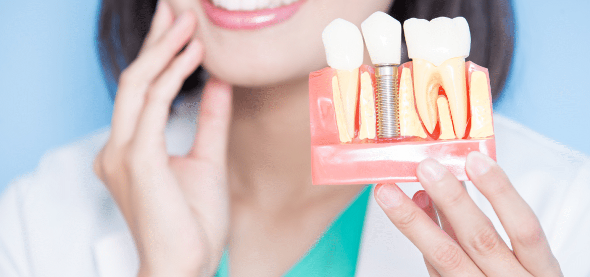 dental_implants_Kalispell_dentist