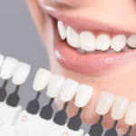 professional_teeth_whitening_Kalispell_dentist