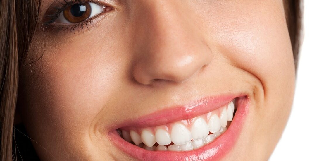 Teeth Whitening in Kalispell